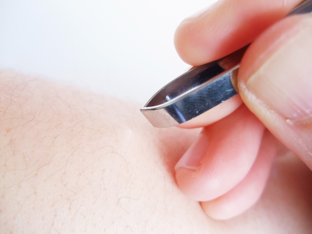 毛抜きで腕の毛を抜く様子